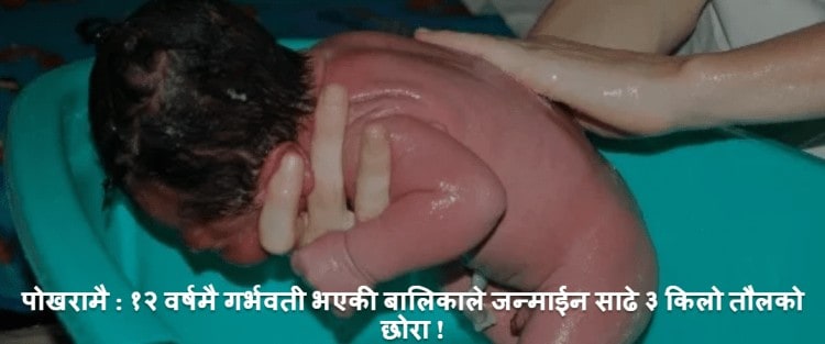 पोखरामा १२ बर्षिया किशोरीले बच्चा जन्माईन्, करणी गरेको भन्दै श्रीमान जेलमा