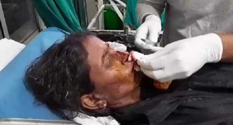 बारामा भीषण हुरीका कारण २४ जनाको मृत्यु