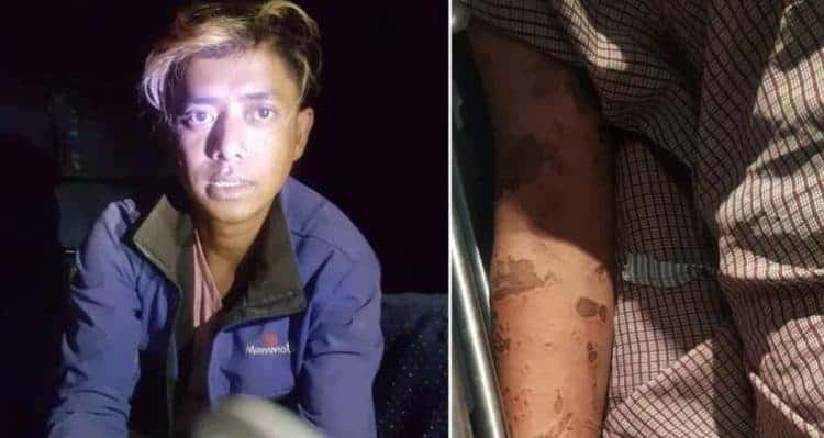 काठमाडौंमा युवतीमाथि एसिड प्रहार, श्रीमान पक्राउ